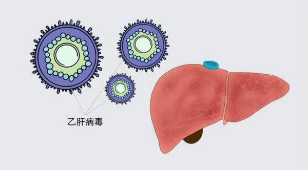 海证资本 乙肝患者必知：十几年不硬化的5个关键护肝举措！